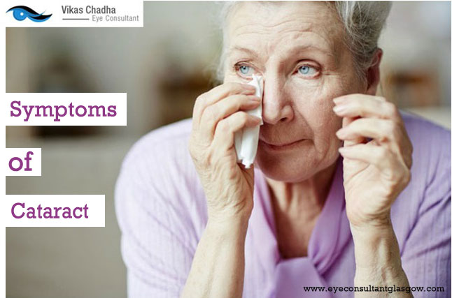 Cataracts Surgery : – Types, Symptoms, Process & Important Facts